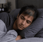 Sleep-Deprived Hair Loss