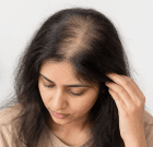 Thyroid Hair Loss