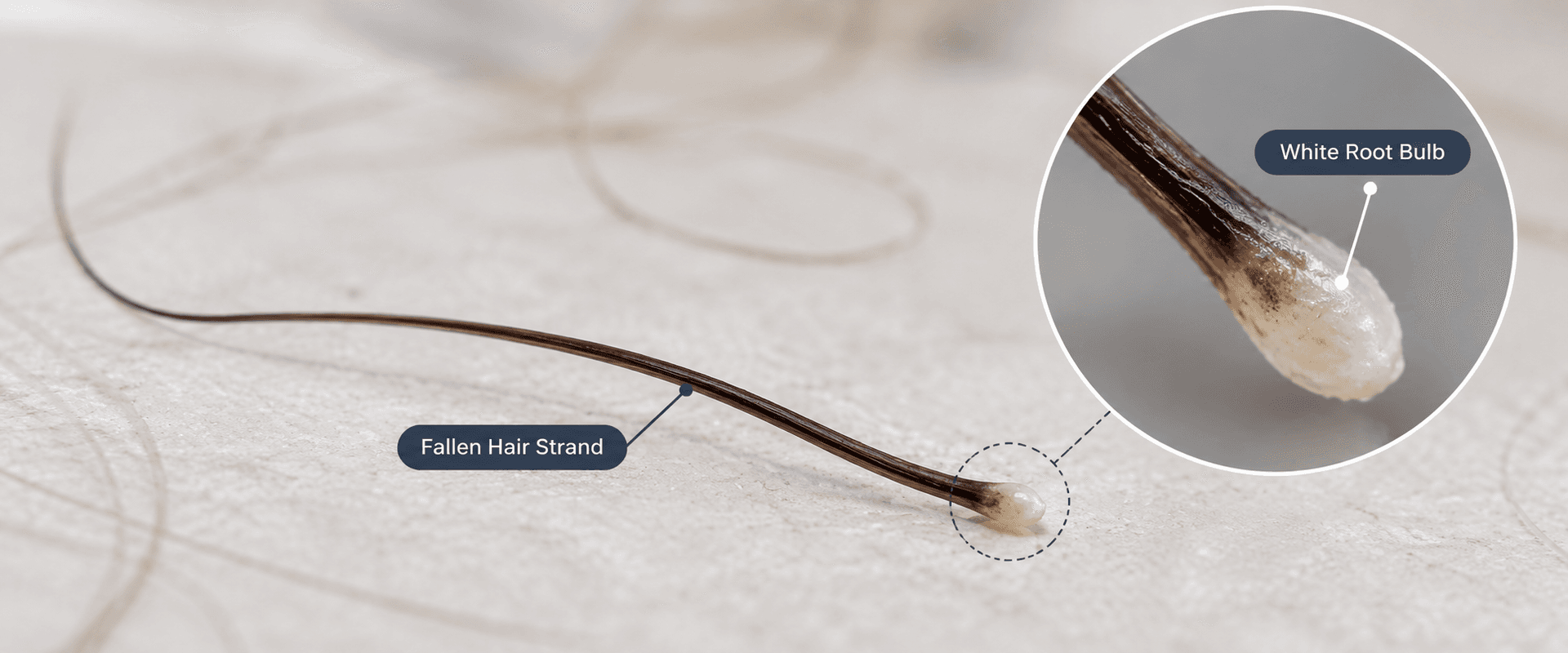 Hair Falling From Root: White Bulb, Causes & What To Do — Hairsncares Fallen hair strand with a small white root bulb at the root end illustrating hair shedding from the root