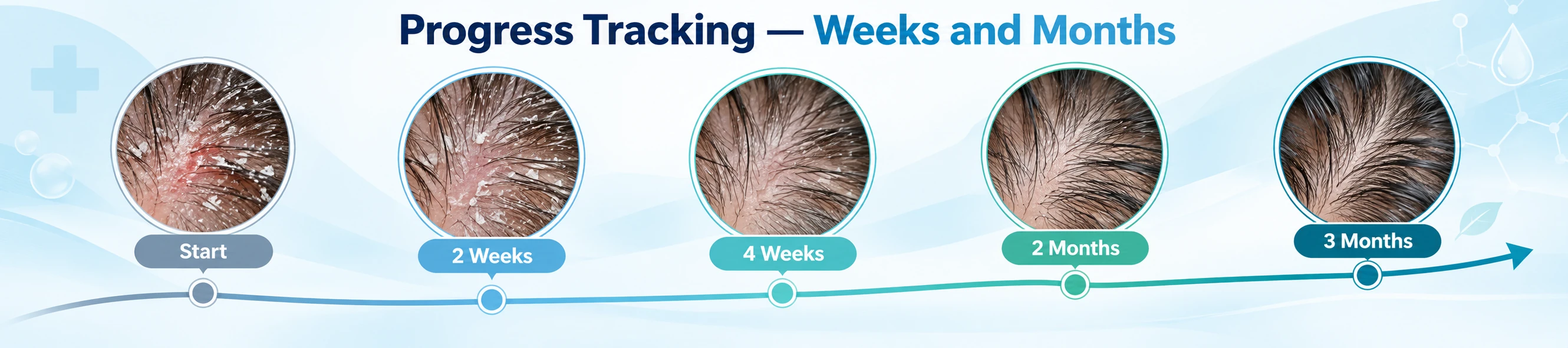 Five-step hair care routine showing scalp cleansing, gentle detangling, conditioning, heat protection, and progress tracking.