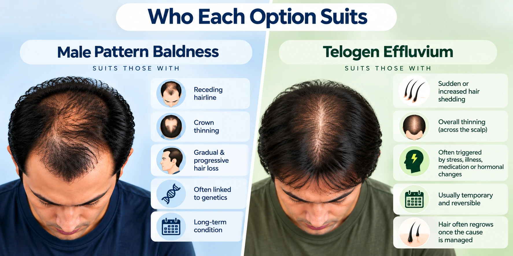 Male pattern baldness vs telogen effluvium visual comparing receding hairline, crown thinning, gradual hair loss and sudden diffuse shedding.