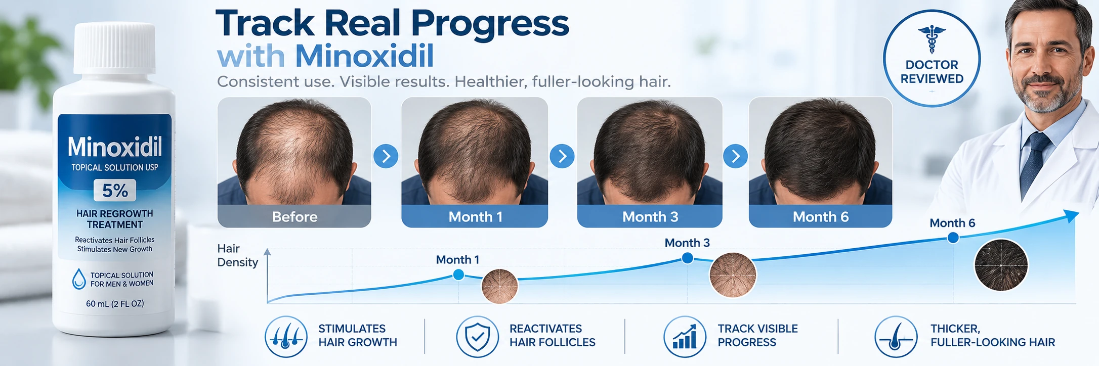 Illustrated Minoxidil application routine with step-by-step scalp use