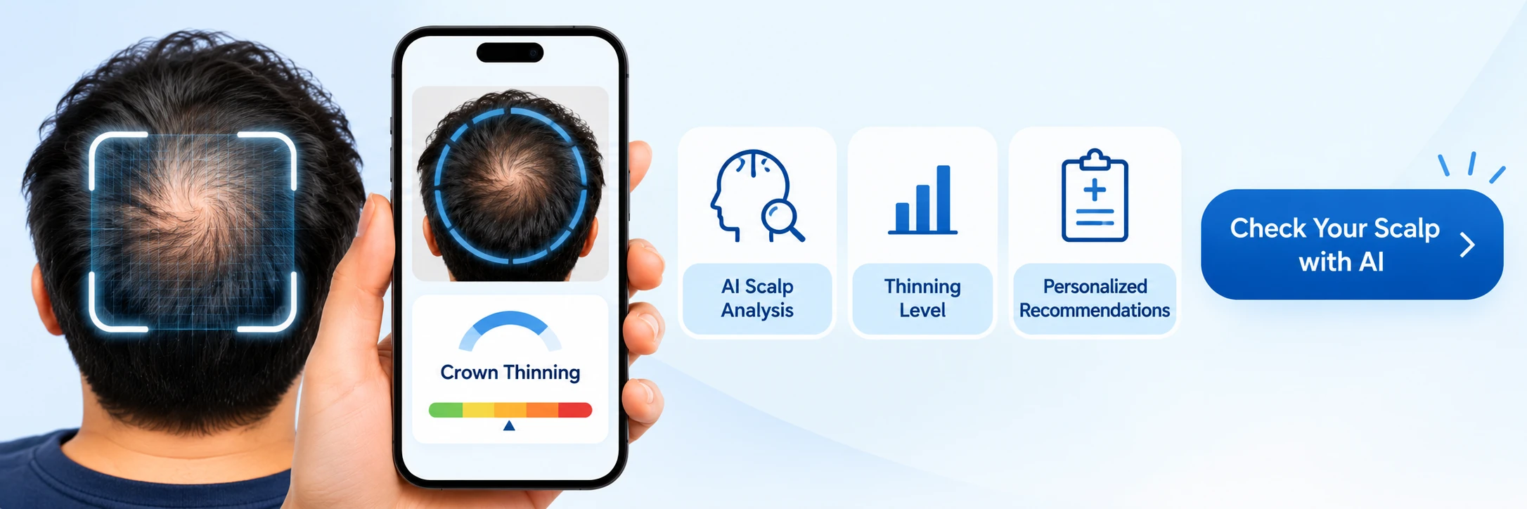 AI Crown Thinning & Scalp Checker AI scalp checker analyzing crown thinning and hair density to identify the level of hair loss.