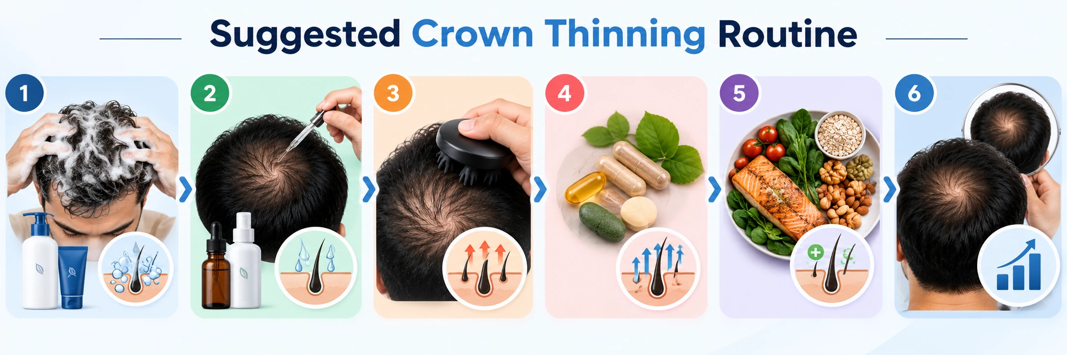 Suggested Crown Thinning Routine Suggested crown thinning routine showing scalp cleansing, topical treatment, scalp massage, supplements, healthy diet, and progress tracking.