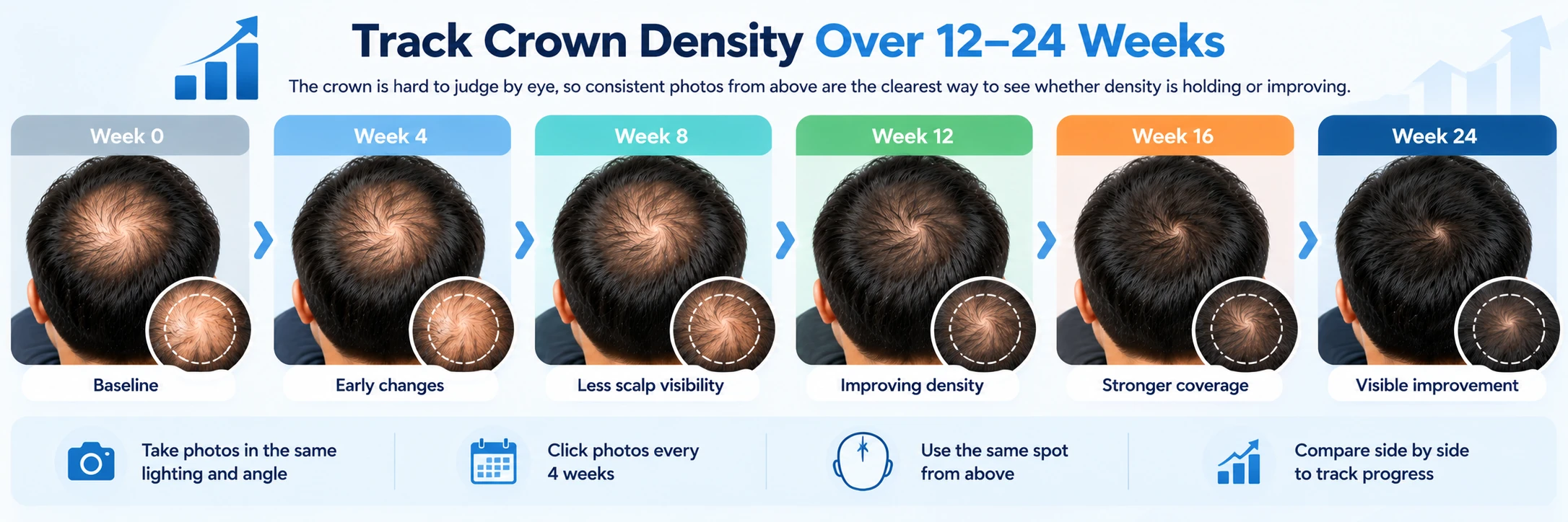 Track Crown Density Over 12–24 Weeks Crown hair density progress tracking from week 0 to week 24 using consistent scalp photos to monitor thinning and improvement.