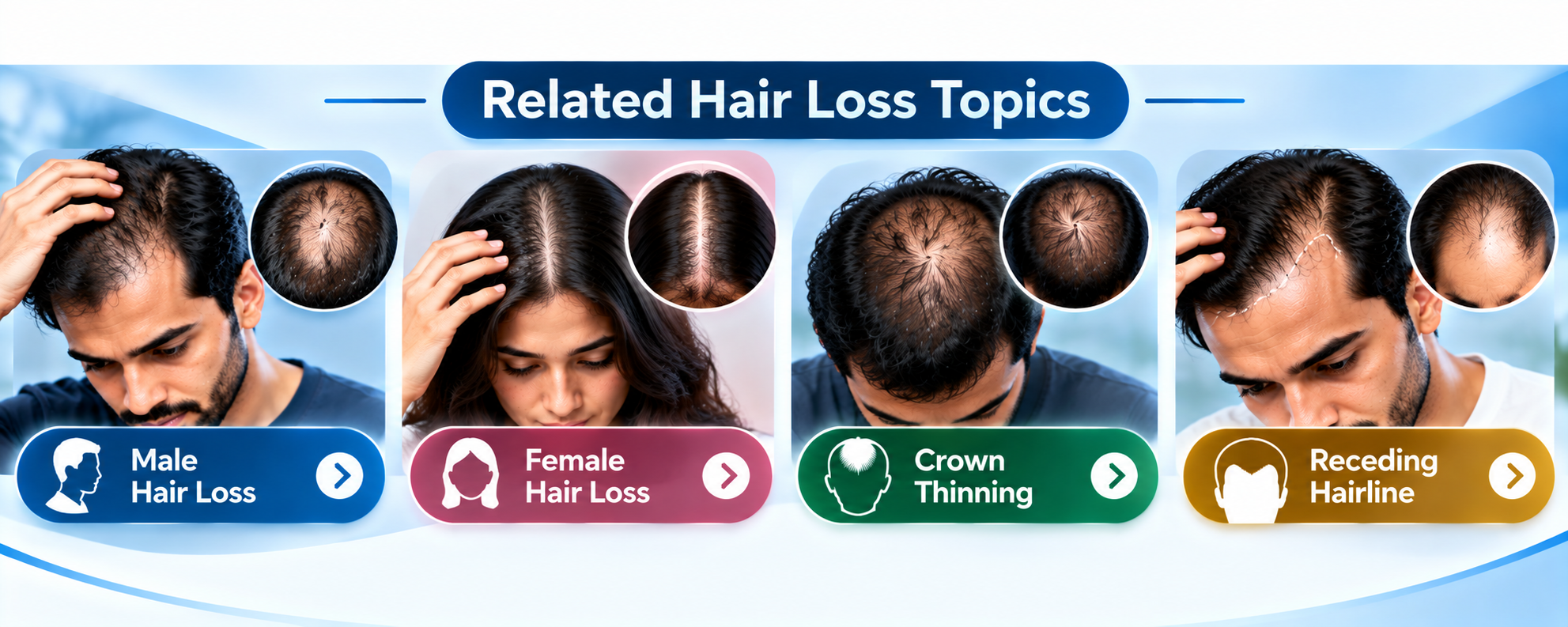 Related hair loss topics including male hair loss, female hair loss, crown thinning, and receding hairline