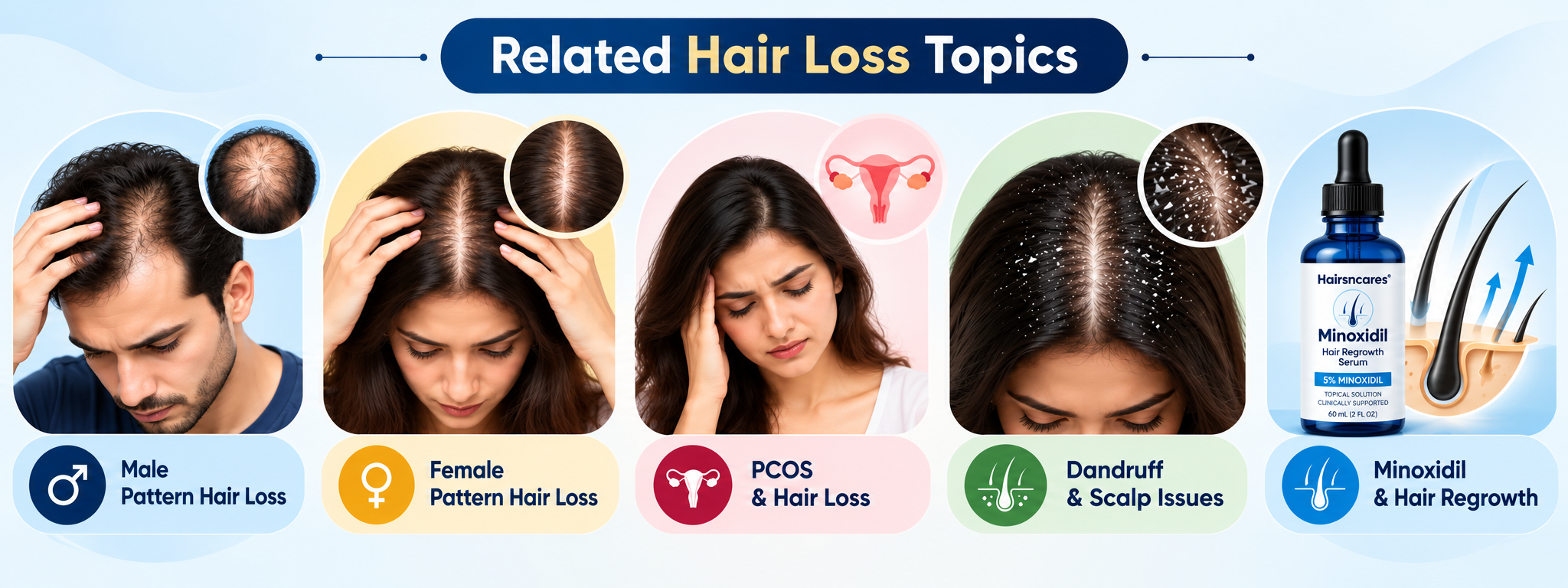 Related hair loss topics including male pattern hair loss, female pattern hair loss, PCOS, dandruff and Minoxidil