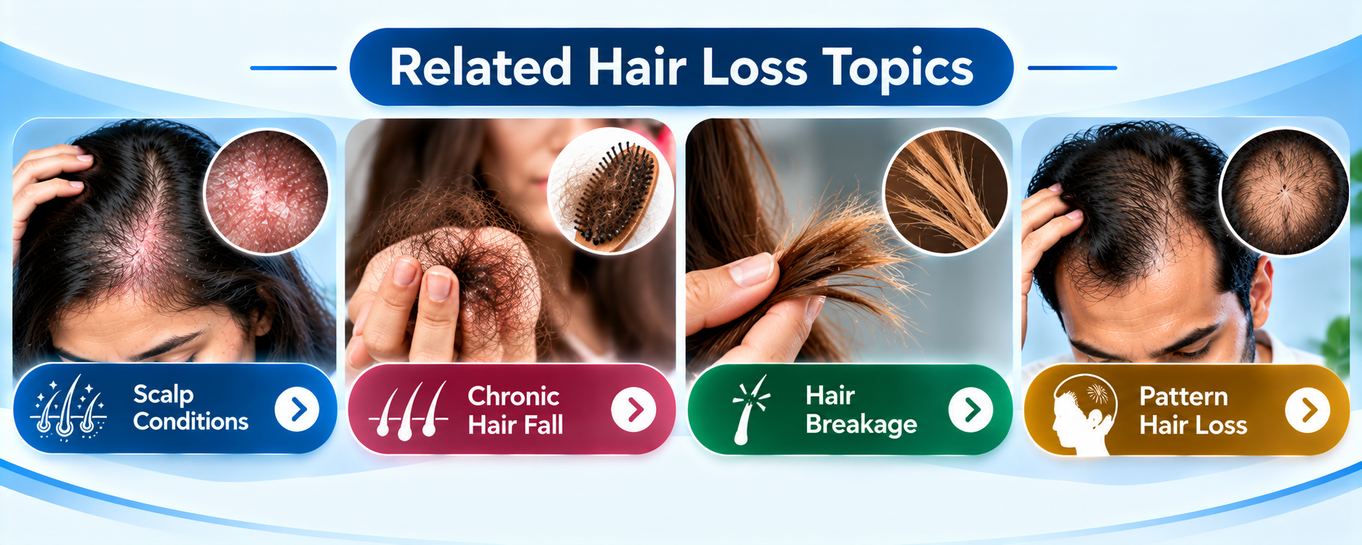 Related hair loss topics including scalp conditions, chronic hair fall, hair breakage, and pattern hair loss