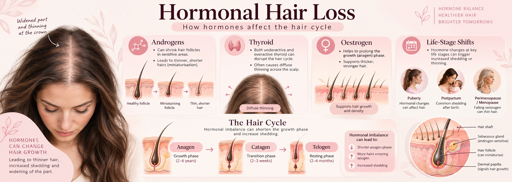 Hormonal hair loss explainer showing androgens, thyroid, oestrogen and life-stage shifts affecting the hair cycle