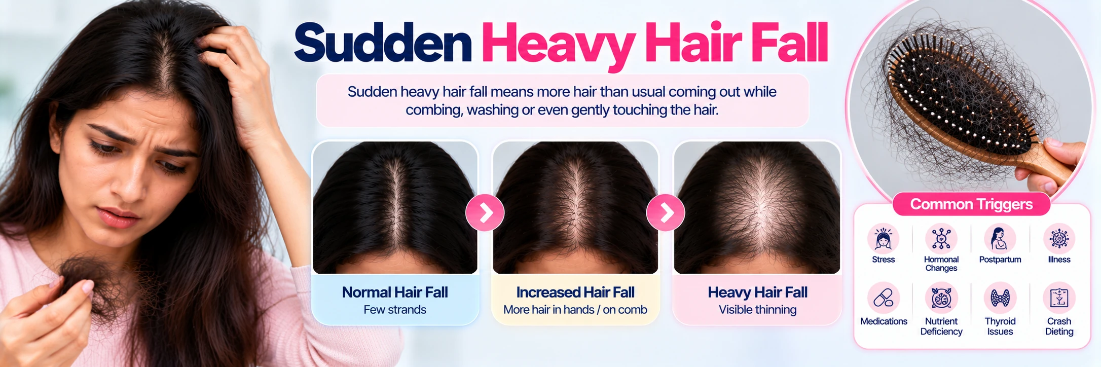 Sudden heavy hair fall in women, the shedding pattern seen after illness, stress or childbirth